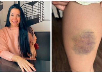 Nutricionista cearense que lutou contra homem para não ser estuprada em SP diz que aprendeu artes marciais em Fortaleza