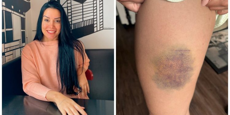Nutricionista cearense que lutou contra homem para não ser estuprada em SP diz que aprendeu artes marciais em Fortaleza