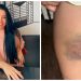 Nutricionista cearense que lutou contra homem para não ser estuprada em SP diz que aprendeu artes marciais em Fortaleza